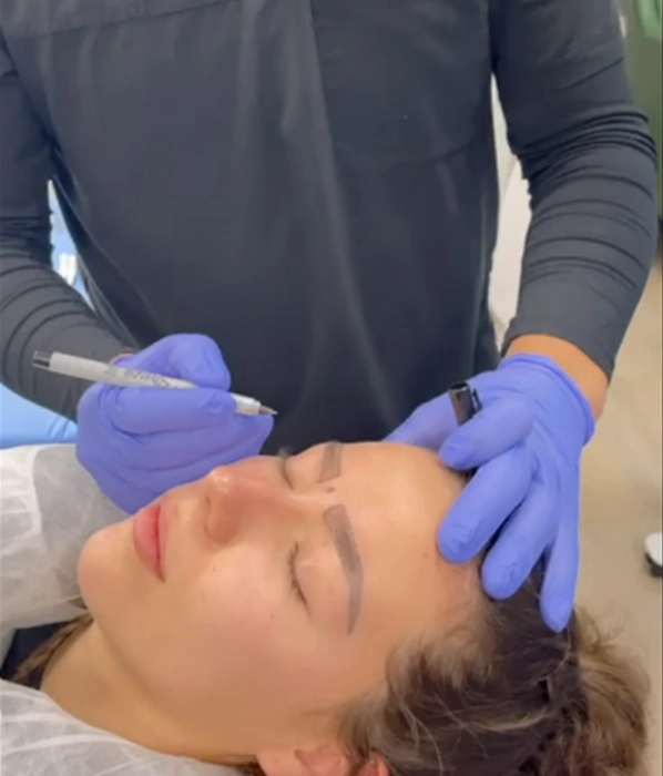 Eyebrow Transplant — Graft placement — patient at Inside Out Medical Center, Fresno