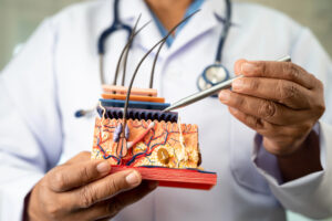 A hair transplant specialist in a white coat holds a medical model of human skin with visible layers and hair follicles, pointing to a section with a metal instrument. A stethoscope hangs around their neck at the best hair transplant clinic.